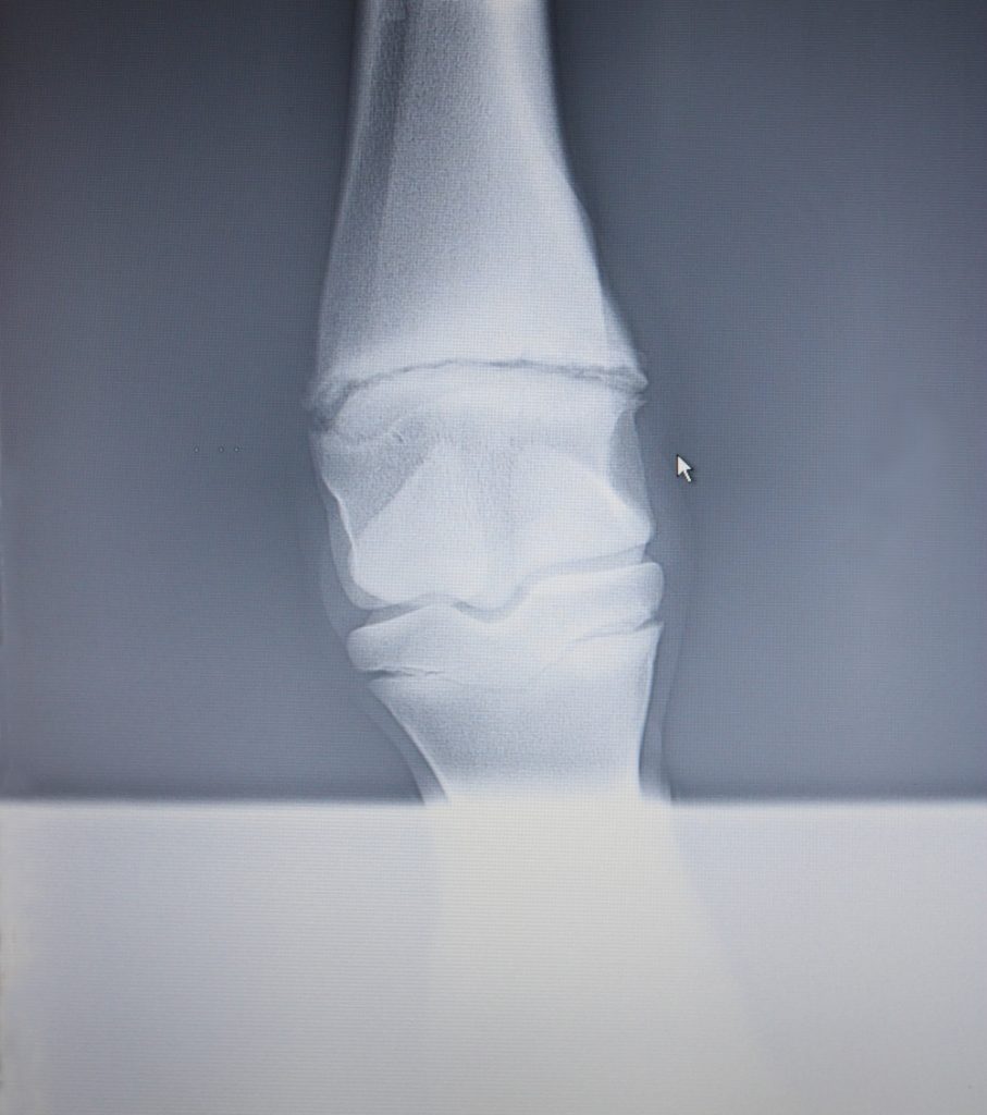 Epiphysial cartilages and severe fetlock misalignment X-ray - epiphysial cartilages and severe fetlock misalignment